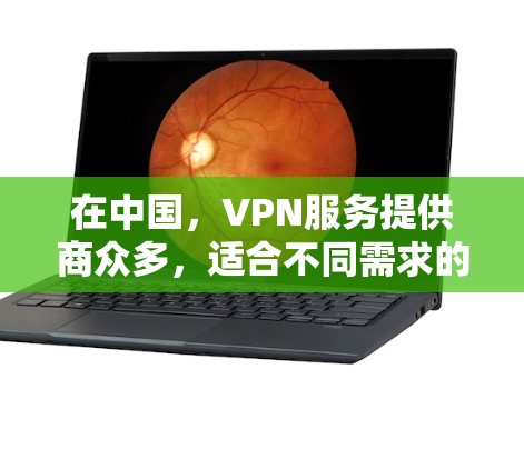 在中国，VPN服务提供商众多，适合不同需求的用户选择。以下是一些在用户中较为常见的VPN服务推荐